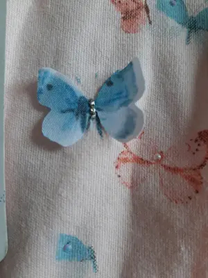 Photo from the official notice: Tongs baby baby's bodysuit — choking risk