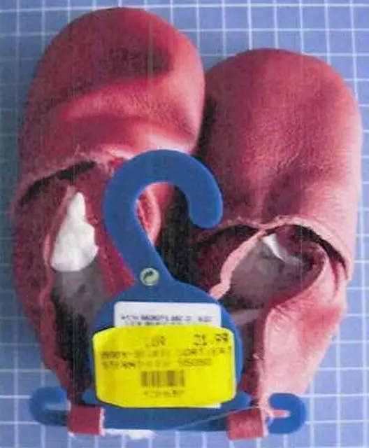 Foto aus der offiziellen Meldung: Sterntaler Babyschuhe "Leder-First-Walker-Schuhe für Chil — Risiko: Chemikalie (1278/11)
