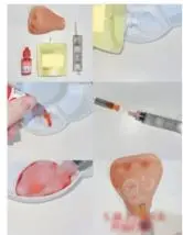 Photo from the official notice: Pimple Popping Squishes containing needles sold via OnBuy — injuries risk
